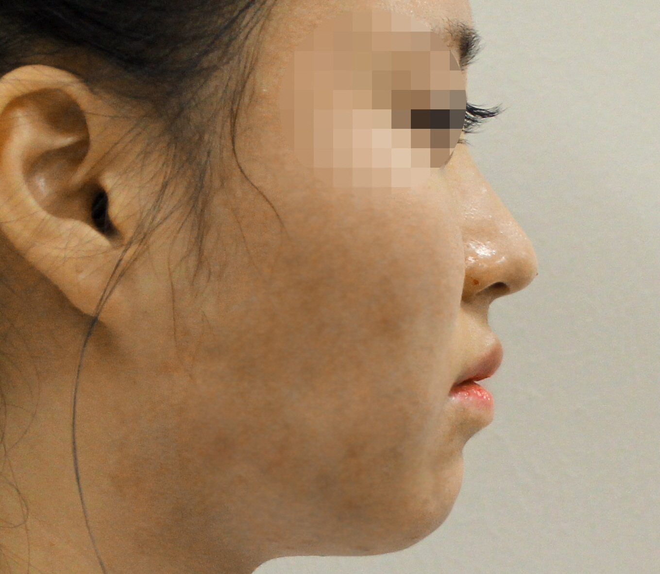 미쥬코  After
