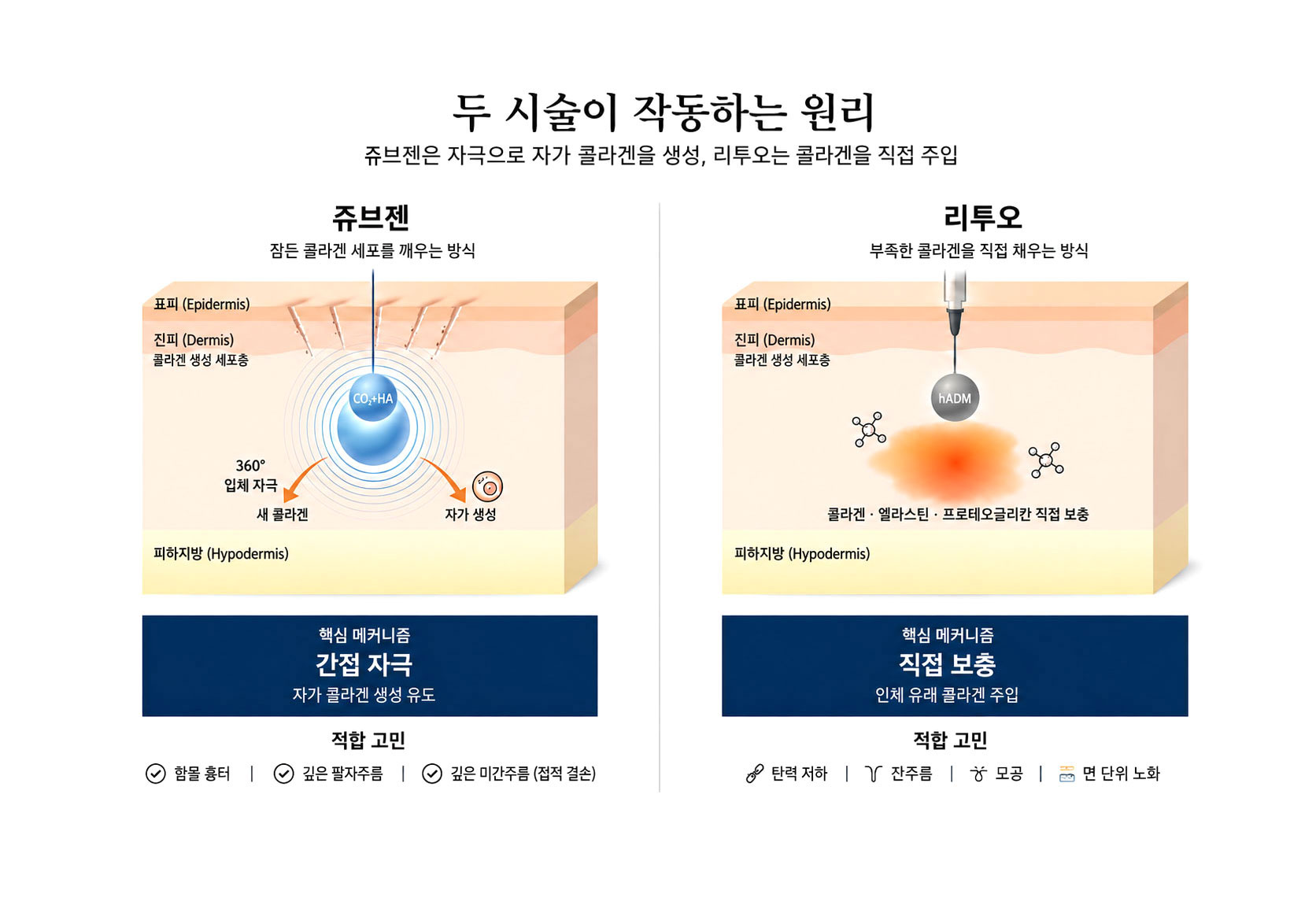리투오 vs 쥬브젠 작용 메커니즘 비교