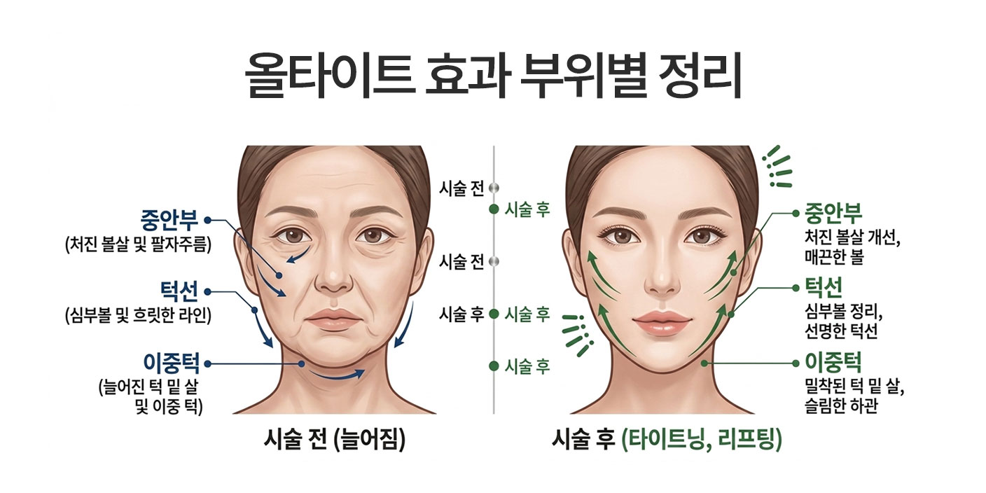 올타이트 효과 시점과 지속