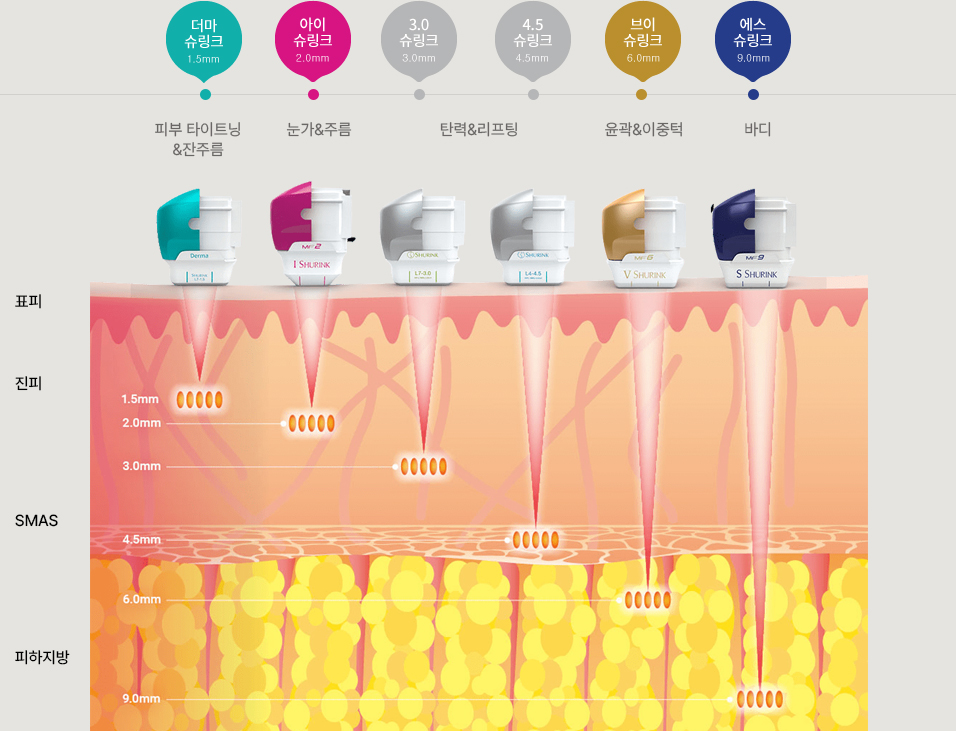 슈링크 원리