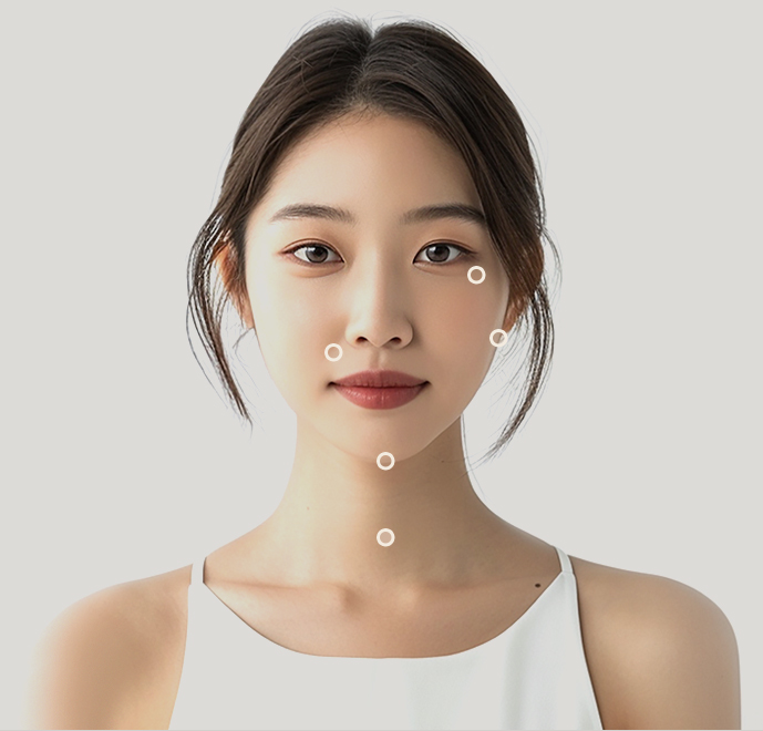 슈링크 리프팅 시술 부위
